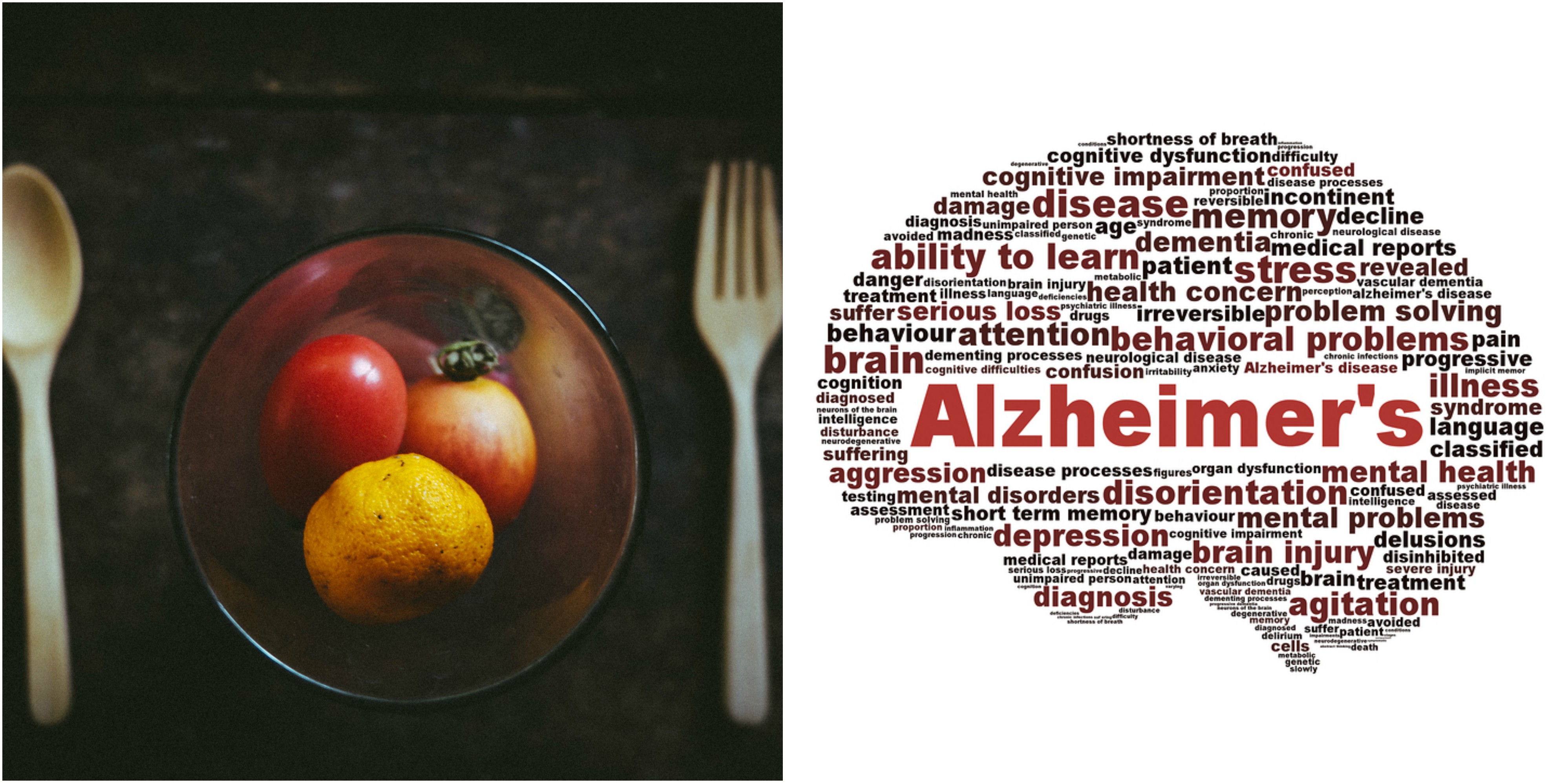 Alzheimer’s Disease And Nutrition: Can It Help? – AFIYA Magazine